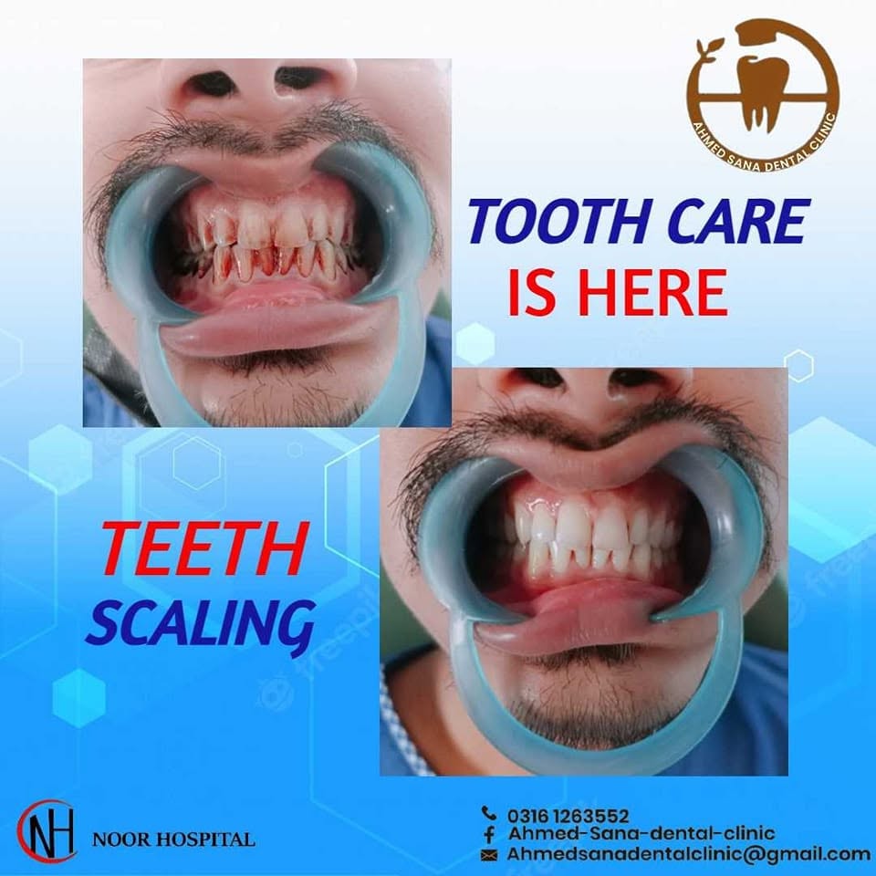 Treatment room at Ahmed Sana Dental Associates